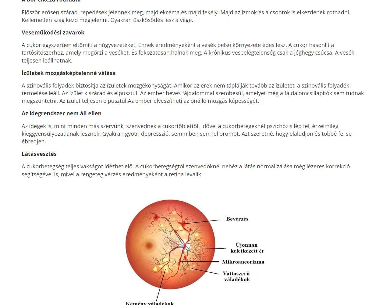 Diaform 4