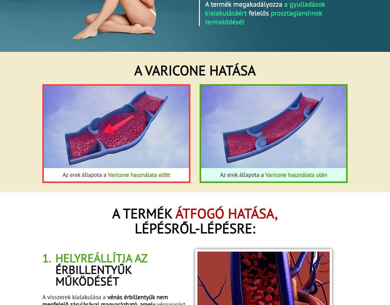 Varicone 5