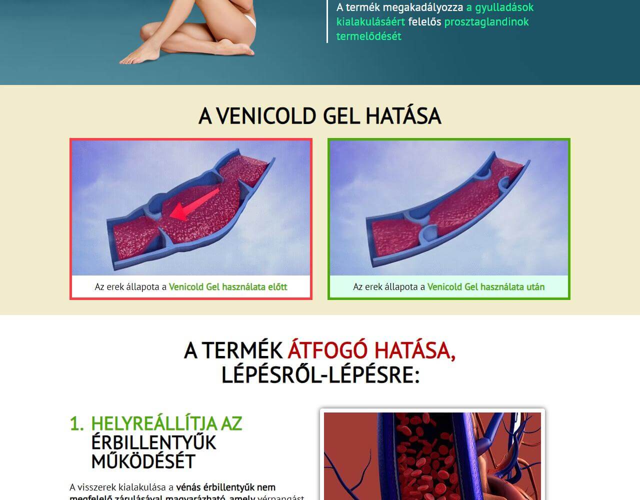 Venicold Gel 5